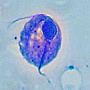 Trichomonas