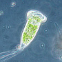 Vorticella sp.