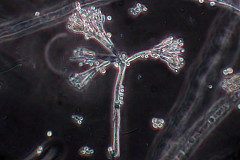 Penicillium in phase contrast