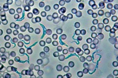 Trypanosoma in phase contrast